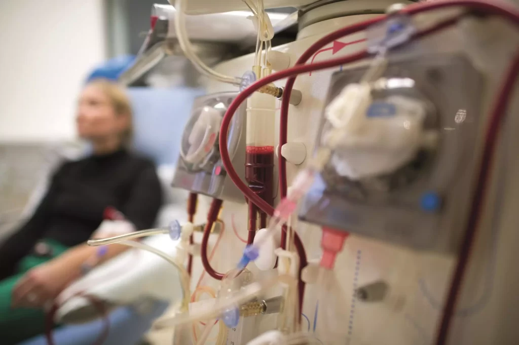 PhilHealth Nagpabuti ng Z Benefit Package para sa Peritoneal Dialysis